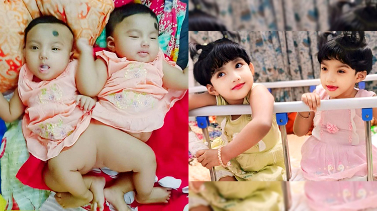 বাড়ি যেতে পারছে না নুহা-নাবা: হাসপাতালের বিল ২২ লাখ