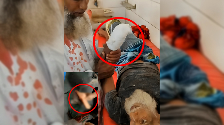 শ্রীপুরে জমি নিয়ে বিরোধে কৃষকের হাতের কব্জি বিচ্ছিন্ন